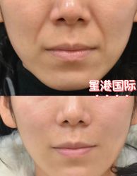 -星港国际·Skin皮肤专研·皮肤管理