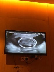 -重庆安琪儿妇产医院-妇幼保健联盟医院