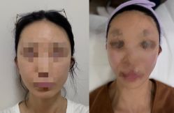 -北京漾格医疗美容医院