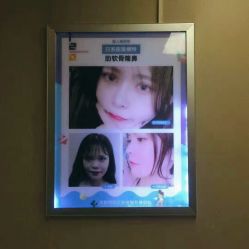 -成都西区医院整形美容