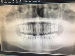 -爱贝口腔·牙周诊疗·种植修复中心
