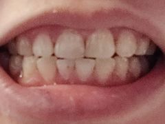 -岳辰齿科(浦东长泰店)