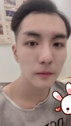 -大麦微针植发丨全国连锁