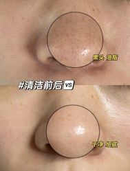 -美愈美肤MEIYU SKIN