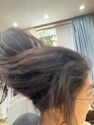 -大麦微针植发全国连锁