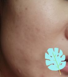 -西安伊美尔医疗美容医院