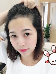 -大麦微针植发丨全国连锁