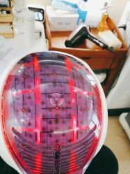 体验后-碧莲盛·不剃发植发