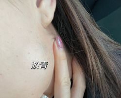 体验后-北京新星靓医美