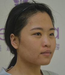 -深圳悦她医疗美容