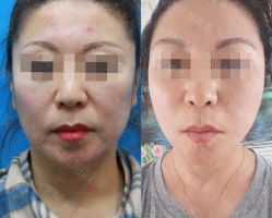 -加减美医美连锁品牌