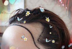 -大麦微针植发全国连锁