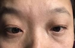 -天津健丽·去眼袋医疗美容机构