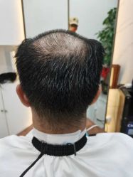 -发饰美男士增发补发假发定制店