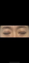 体验后-大连美天医疗美容医院