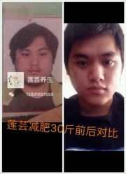 -莲芸拔罐减肥