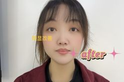 -天津健丽·去眼袋医疗美容机构