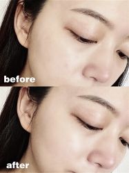 -美壹生诊所皮肤管理中心·海菲秀&Legacy美白舱