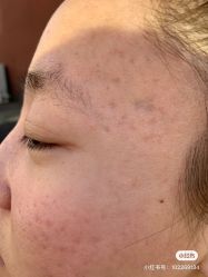 -苗方清颜痘肌研究所