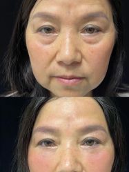 -深圳艺星医疗美容医院