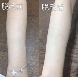 -Yestar艺星医疗美容医院