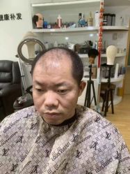 -靓康增发补发假发