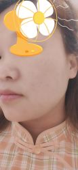 -正璞医疗美容·皮肤修复·微整注射