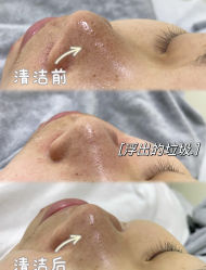 -LUNA皮相美·骨相美高级美感