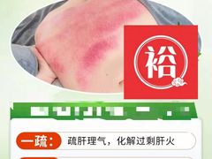 -裕和堂中医推拿艾灸(太古汇臻品店)