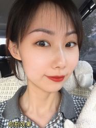 点击看大图 体验后-天津时光诺颜·轻医美·轮廓抗衰中心