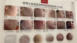 -痘博士烟台·全国连锁祛痘机构