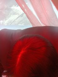 -碧莲盛·不剃发植发