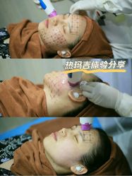 -恒妍医美·韩国定制抗衰中心