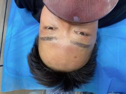 点击看大图 体验后-重庆联合丽格第五医疗美容医院