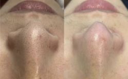 -Return·蕾特恩祛痘·皮肤管理中心