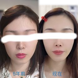 点击看大图 -Verywang半永久纹眉•仪器野生眉