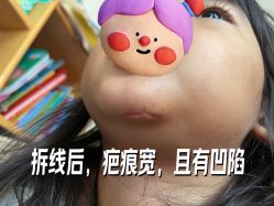 -首都医科大学附属北京儿童医院