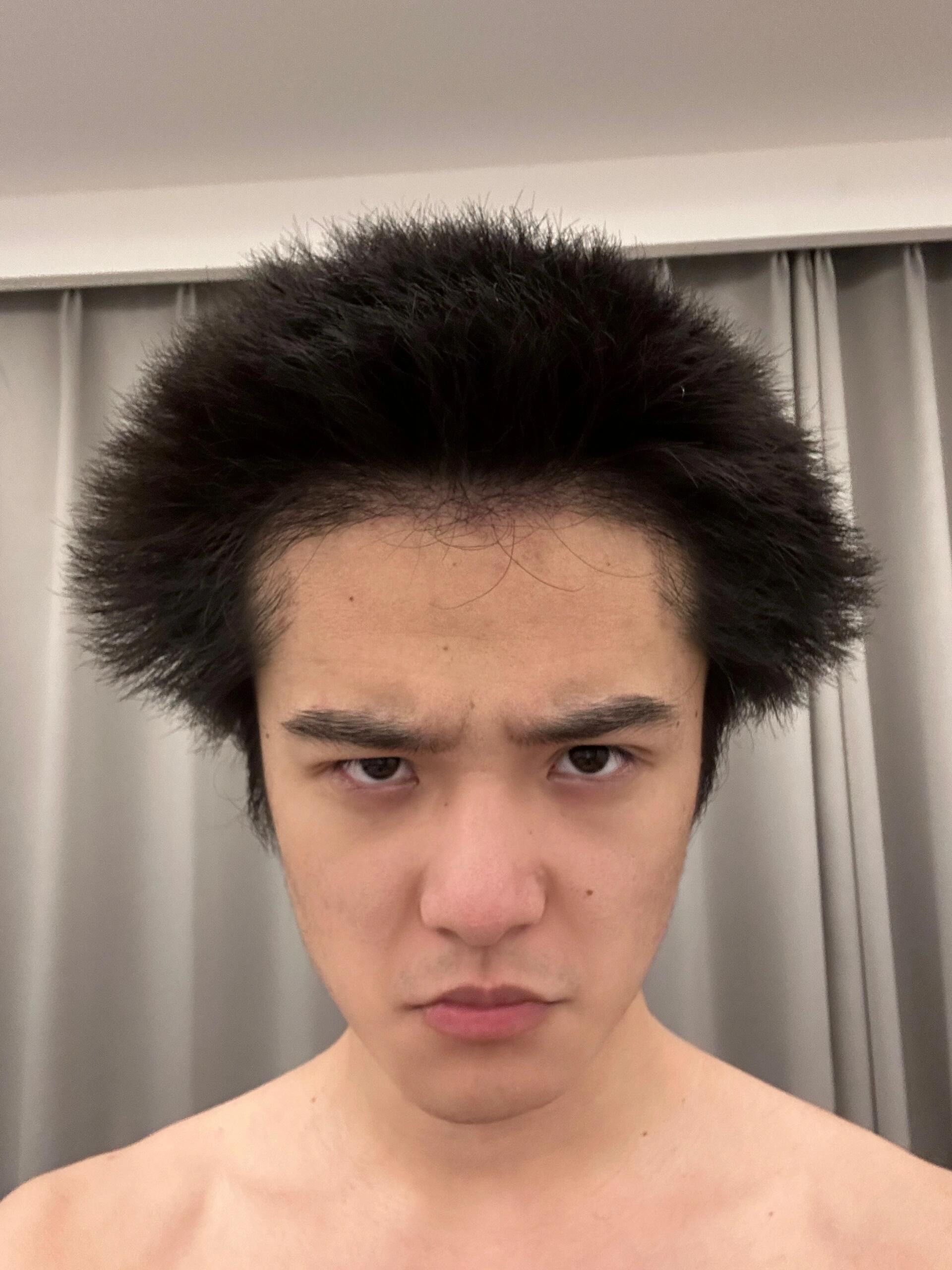 这种发质就什么发型好?除了寸头