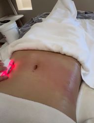 -CICI纤美·科技减肥美容