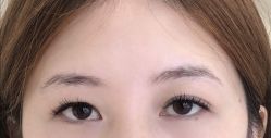 -Doris多里斯半永久纹眉·SMP纹发·发际线
