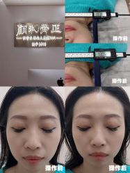 -颜和骨正·明哲式骨相美学整骨
