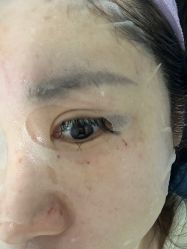 -美安心医美·美迪迈黄金微针·美拉美医疗美容