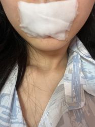 点击看大图 -OnFaer.纹眉半永久无创洗眉