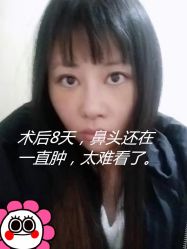 -成都西区医院整形美容
