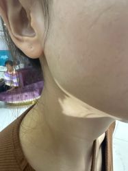 -广州美莱医疗美容医院