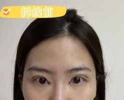 -素美医疗美容·西南眼鼻整形·修复基地
