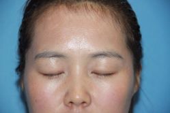 -东莞缔美美容医院