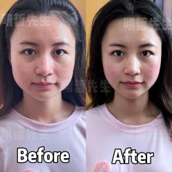 -颜和骨正&明星徒手小颜整骨