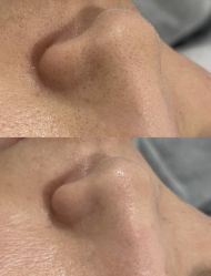 -SKIN79皮肤管理中心