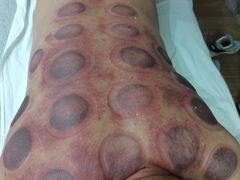 -深蓝盲人推拿·颈肩腰腿疼痛·艾灸调理(清河店)